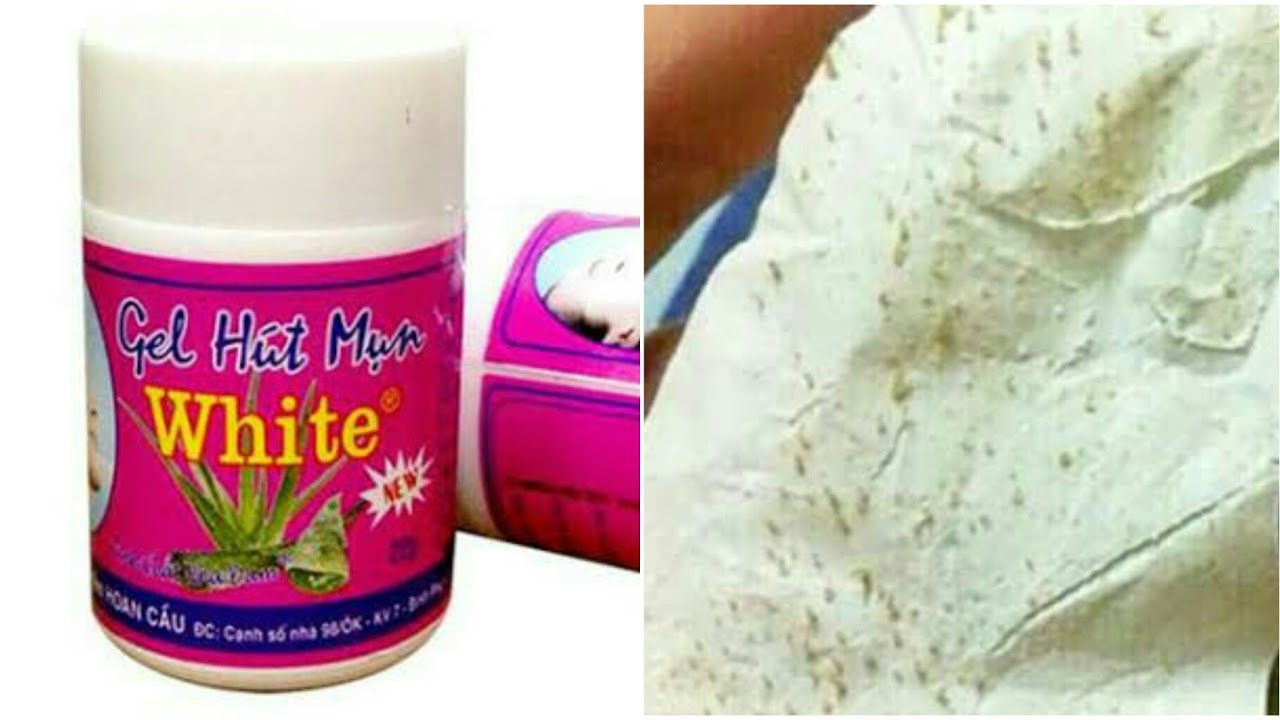 Gel Hut Mun White Blackheads Remover Review YouTube