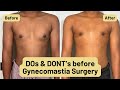 Top Gynecomastia Surgeon shares Dos &amp; Don'ts before Surgery