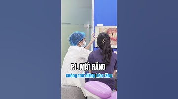P1| Ca mất răng nhưng không thể niềng kéo răng #bacsiphamdung #lacvietintech #niengrang #implant