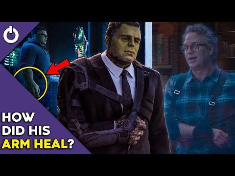 Why Smart Professor Hulk’s Arm Is Not Damaged Anymore?