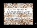 How to intepret a PD-L1 immunostain