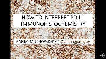 How to interpret a PD-L1 immunostain