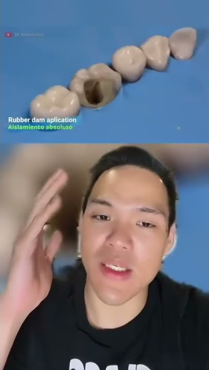 Proses penambalan gigi yg bolong sampe ke akar ‼️😱 #Shorts #YouTubeShorts