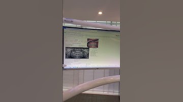 Với hỗ trợ của công nghệ, việc tư vấn của bác sỹ trở nên dễ dàng hơn bao giờ hết #nhakhoahungcuong