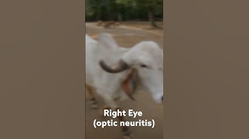 Optic Neuritis in Multiple Sclerosis. Now you see what I see!! Experience MS with me!