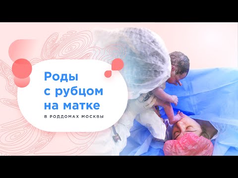 Роды с рубцом на матке бесплатно по полису ОМС в роддомах Москвы