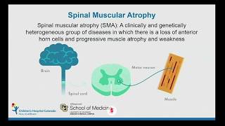 Colorado Virtual Education Screening: Spinal Muscular Atrophy (SMA)