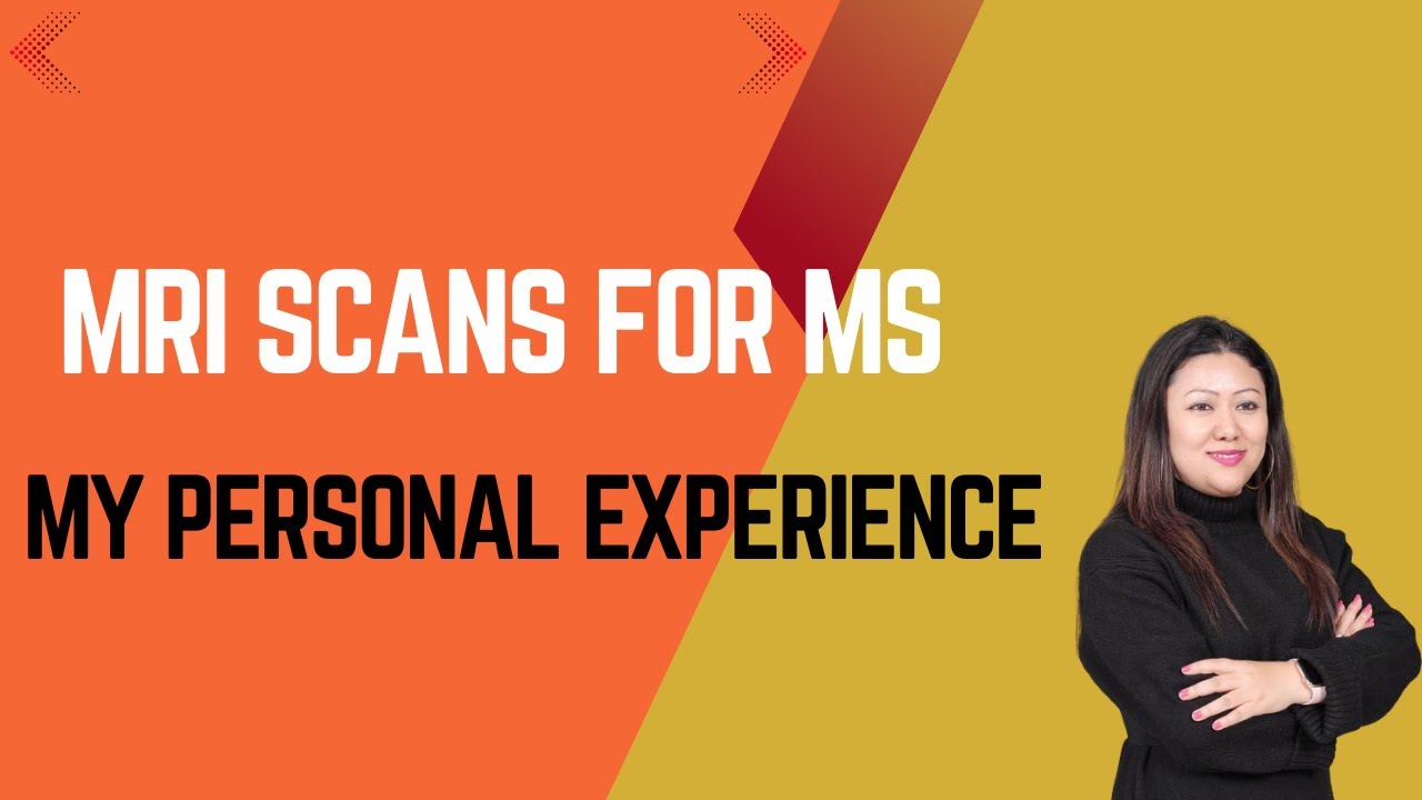 MRI Frequency for Multiple Sclerosis: How It Changed Over Time