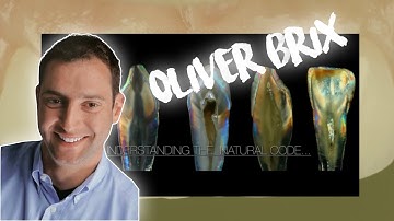 Stain or layering ceramics? Ceramic buil-up. Anterior ceramic build-up. Part#1