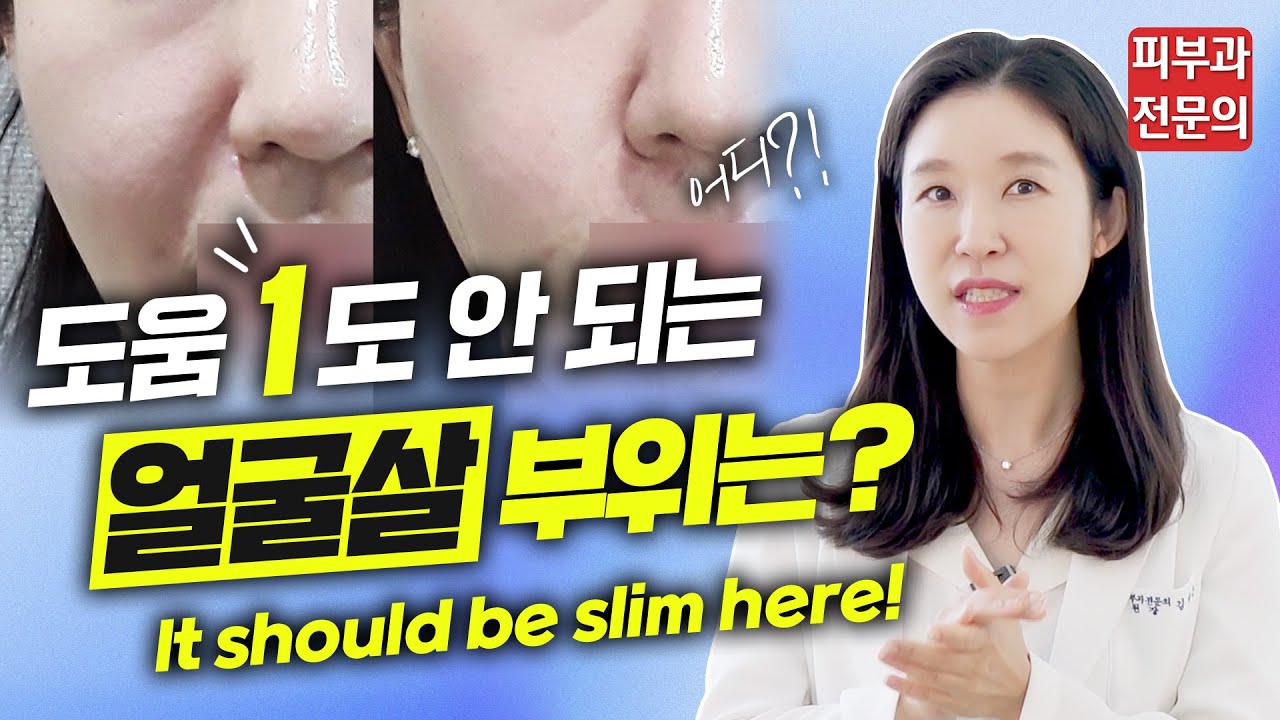 (*ENG/CHN/JP)  얼굴 이 부위에 살 많은 분들 제발 보세요!😭 It should be slim here! - 피부과전문의 [닥터필러]