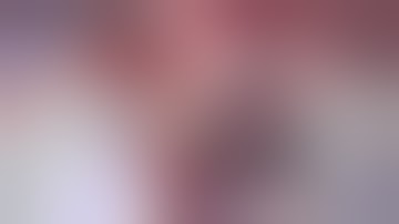 Microsurgical Clipping of Large Anterior Communicating Artery Aneurysm