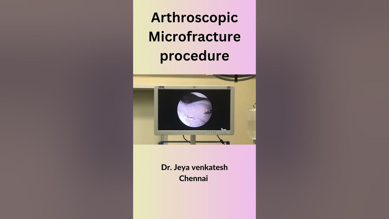 need-knee-pain-relief-here-s-what-you-should-know-about-microfracture