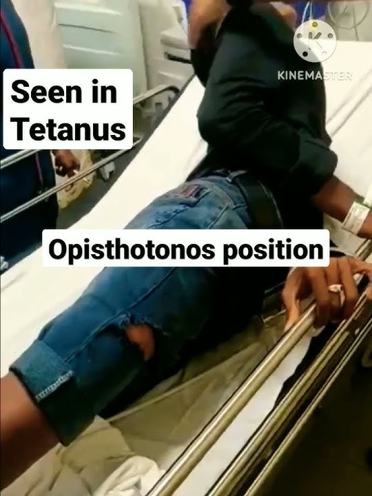 Take Tetanus Vaccine at the time of Injury #mbbs #neet