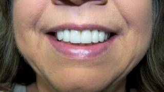 Allure Dental - Time-Keepers Productions