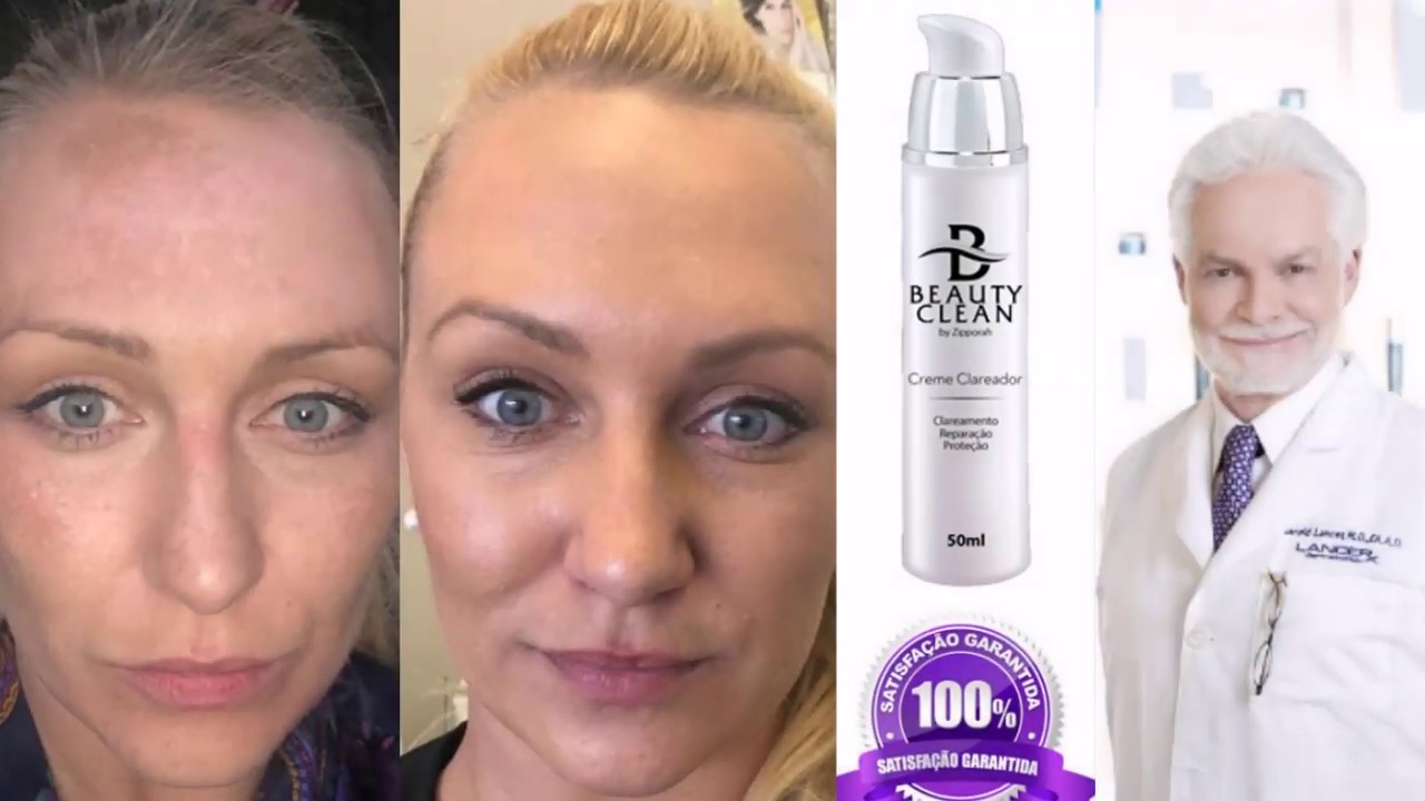 👉Beauty Clean Funciona?💎 Beauty Clean é Bom? 🙋‍♂ Beauty Clean Onde Comprar? Como Tratar o melasma