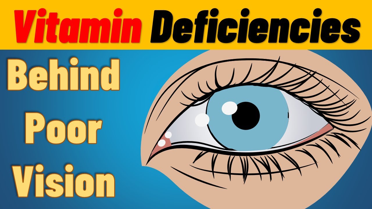 TOP 7 Vitamin Deficiencies Behind Eye Diseases and Poor Vision