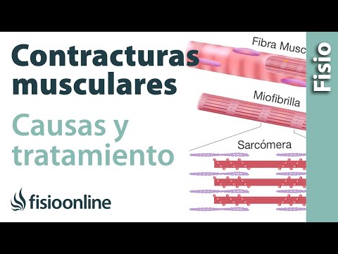 Vídeo: Estirar Los Músculos: Tratamiento, Síntomas