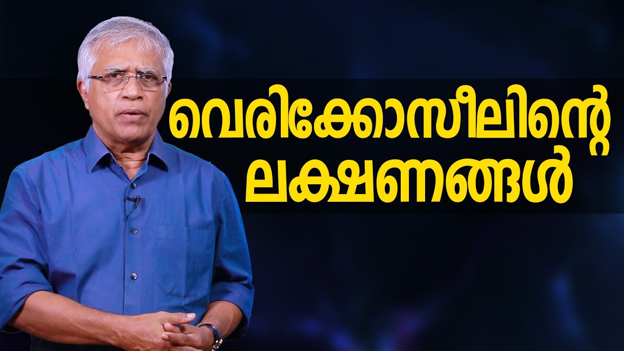 വെരിക്കോസീലിൻ്റെ ലക്ഷണങ്ങൾ