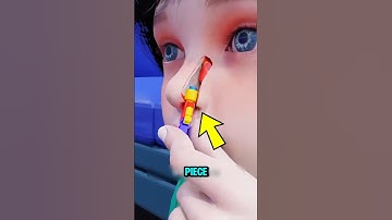 A LEGO Was Stuck in His Nose for 26 Years 🤯