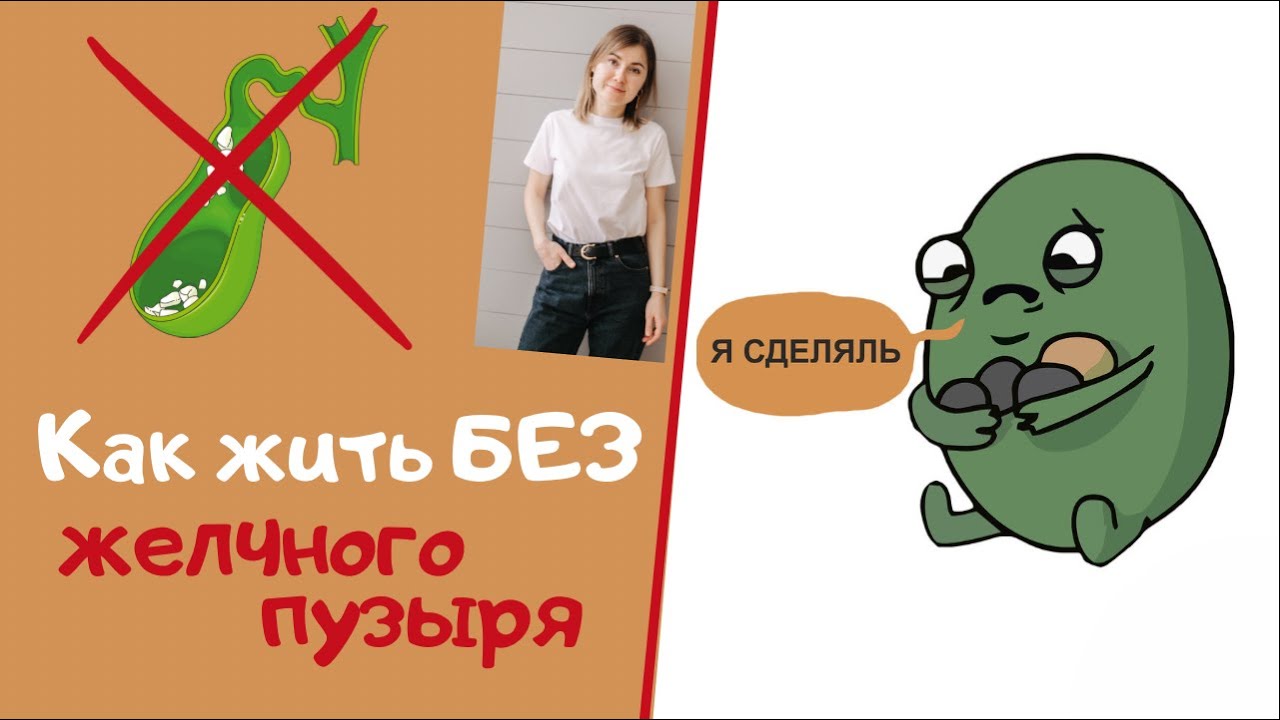 Как живете без желчного отзывы