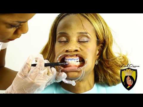 TEETH WHITENING TUTORIAL: How to Start a TEETH Whitening Business & Is Teeth Whitening Legal?