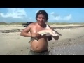 Homem faz graça na praia e leva mordida de tubarão