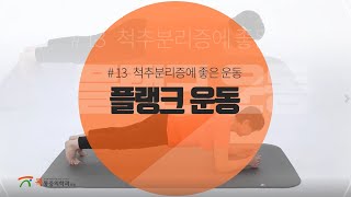 척추분리증 및 전방전위증에 좋은 척추안정화운동 [플랭크]