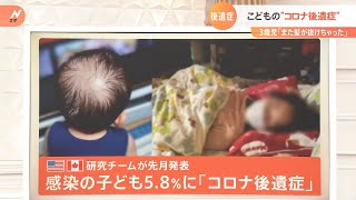 「また髪が抜けちゃった…」息子が“コロナ感染”の医師が警鐘 　子どもの“コロナ後遺症”どんな症状が？｜TBS NEWS DIG