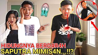 OH MY GOD SAPUTRA WHY IS YOUR NOSE BLEEDING UNTIL IT'S BLEACHING?? | Mikael TubeHD