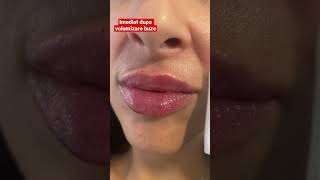 Volumizare Buze, Rezultat Natural Si Fara Durere Programari 0753876867