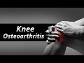 How to take care of Knee Osteoarthritis