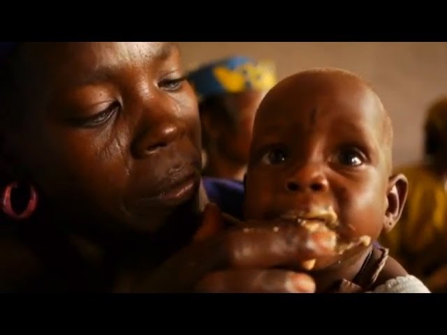 child hunger in africa