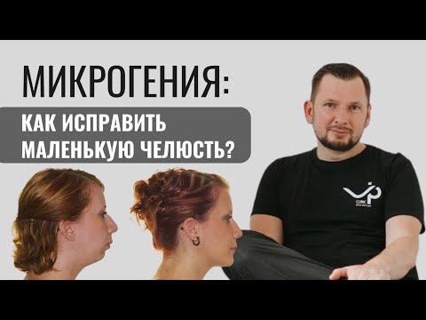 Микрогения. Как исправить маленькую челюсть?