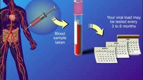 Viral Load and Monitoring