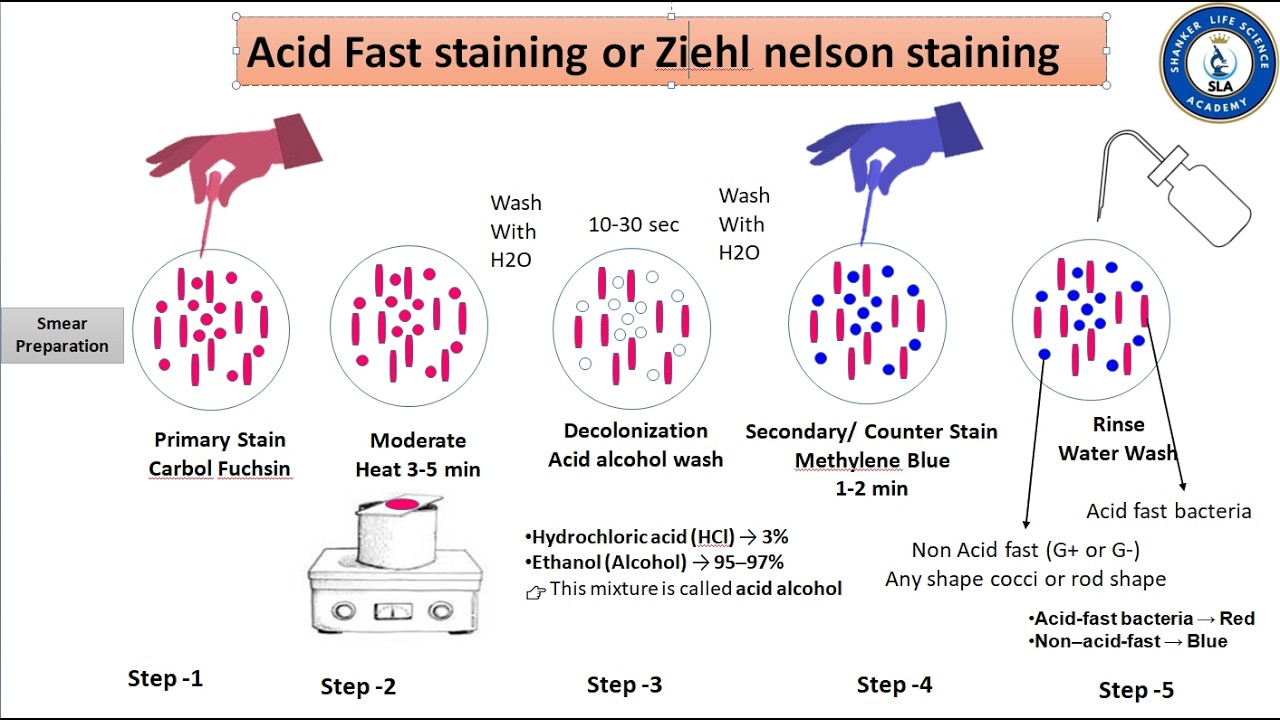 Fast Procedure Acid-fast staining | Procedure, Principle & Results | - YouTube