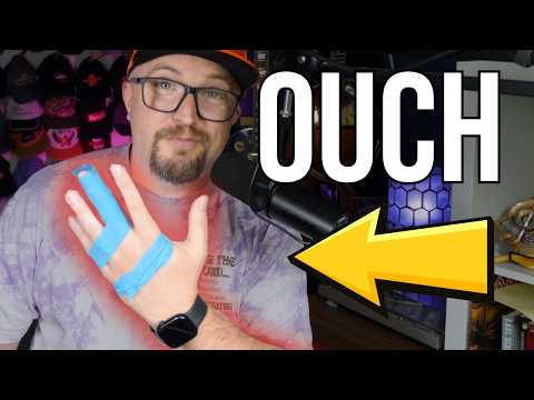 I Injured My Hand. What Happens Now? // Recovery Journal 1