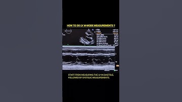 LV M-mode Measurements #echocardiography #echo #cardiology #ultrasound #cardiachealth #hearthealth