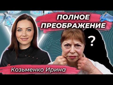 Wanted a second youth. 🤩 Facelift. Lower blepharoplasty. Dr. Irina Kozmenko.
