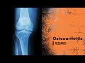 Osteoarthritis research