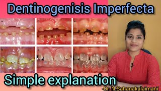 DENTINOGENESIS IMPERFECTA | Simple Explanation| Exam preparation | Dentist