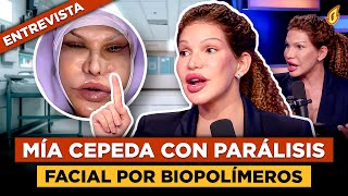 MÍA CEPEDA LLEGA CON PARÁLISIS FACIAL A FOGARATÉ POR POTES DE BIOPOLÍMEROS EN SU ROSTRO (ENTREVISTA)