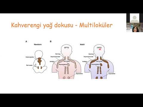 Metabolik Sendrom - Dr. Demet Erdoğan - Bütüncül Tıp Okulu