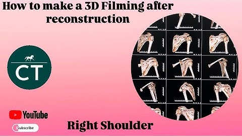 How to make filming || Ct Scan Right Shoulder 3D|| Ge 32 revolution machine