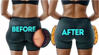 LOSE SIDE HIP FAT | SADDLEBAGS FAT | HIP DIP FAT | Only 5 Min a Day |EASY SIMPLE HIGHLY EFFECTIVE