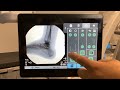 How to Use a C-arm - OEC One CFD Touch Control Panel Basic Operation