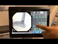 How to Use a C-arm - OEC One CFD Touch Control Panel Basic Operation