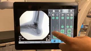 How to Use a C-arm - OEC One CFD Touch Control Panel Basic Operation