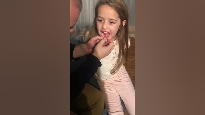 PULLING A TOOTH OUT! IZVADILI SMO PRVI ZUB!!!