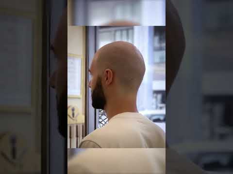 Video: 3 modi per scegliere un taglio di capelli per ragazzi con diradamento dei capelli
