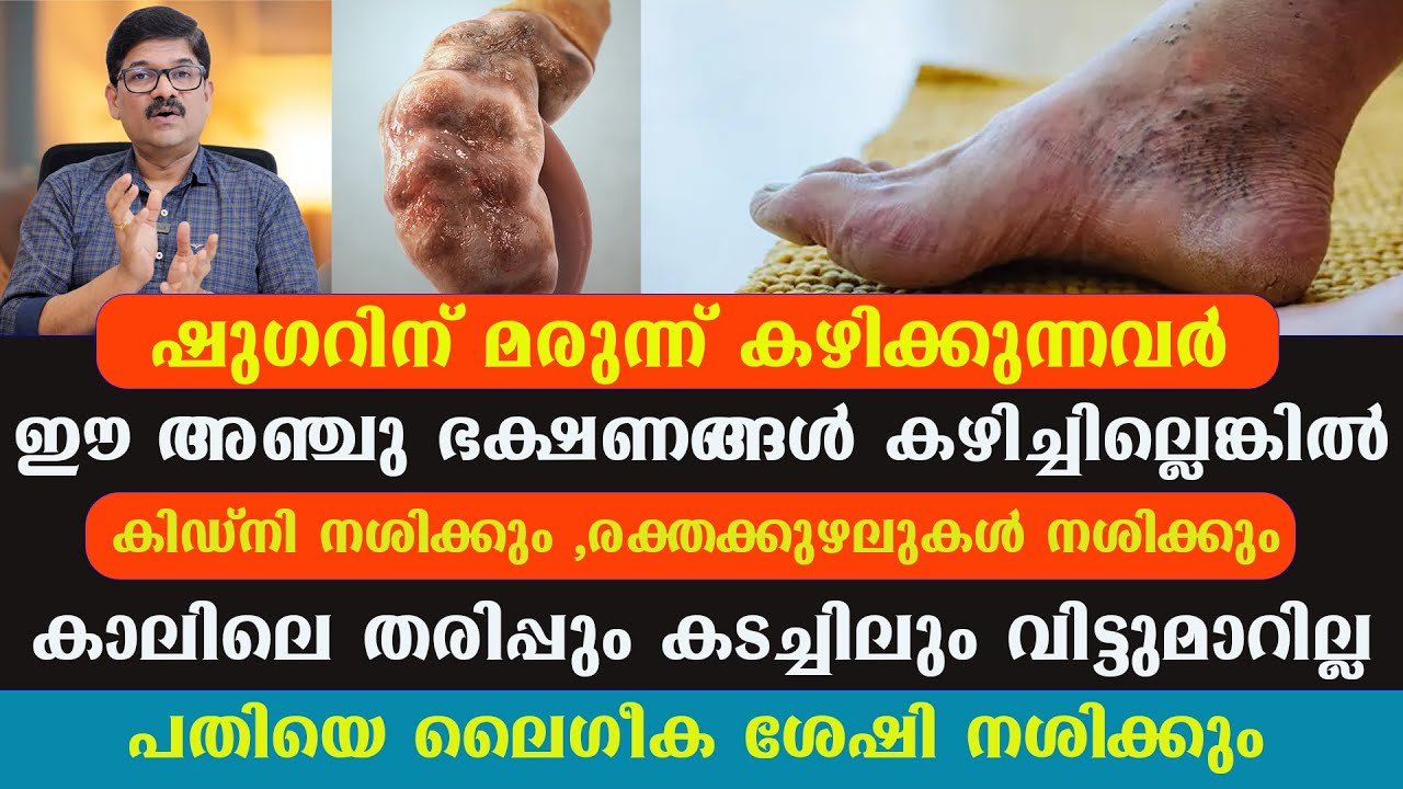 ഷുഗറിന് മരുന്ന് കഴിക്കുന്നവർ ഈ  5 ഭക്ഷണങ്ങൾ കഴിച്ചില്ലെങ്കിൽ / Dr Shimji
